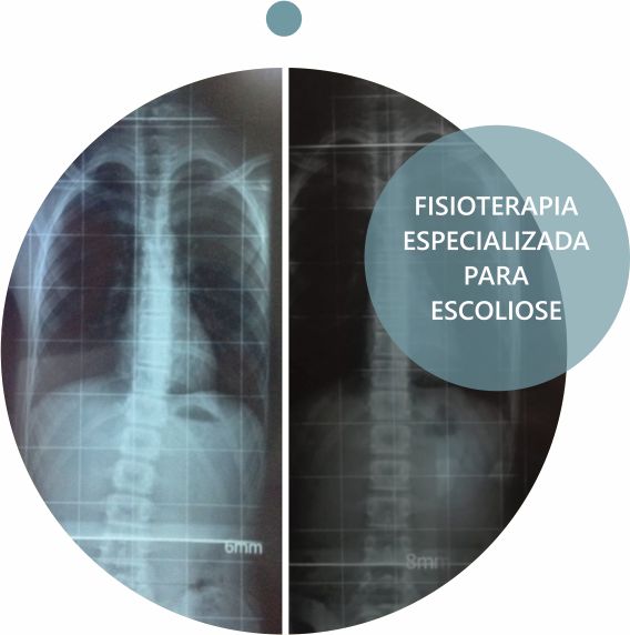 Imagem abstrata de um cérebro de cor azul lilás sobre um fundo preto.